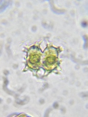 Xanthidium armatum cervicorne