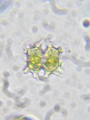 Xanthidium armatum cervicorne