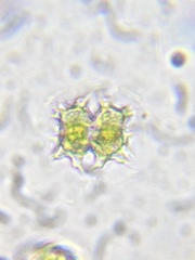 Xanthidium armatum cervicorne