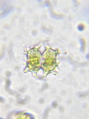 Xanthidium armatum cervicorne