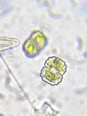 Cosmarium anisochondrum