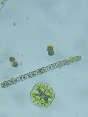 Micrasterias truncata