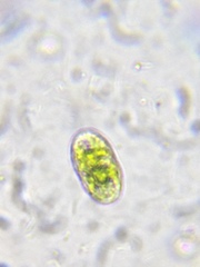 Cylindrocystis
