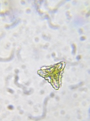 Staurastrum punctulatum