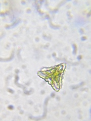 Staurastrum punctulatum