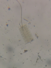 Fragilaria