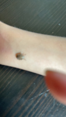 Sphyrocoris obliquus