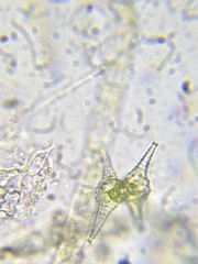 Staurastrum anatinum