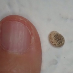 Xerotricha conspurcata