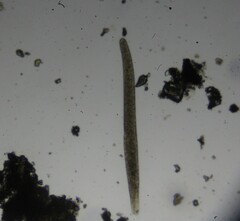 Spirostomum