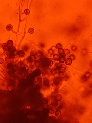 Hypomyces microspermus