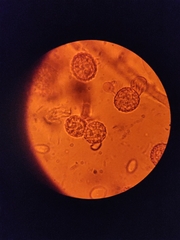 Hypomyces microspermus