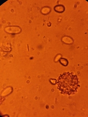 Hypomyces microspermus