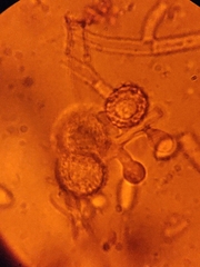 Hypomyces microspermus