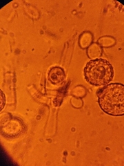 Hypomyces microspermus