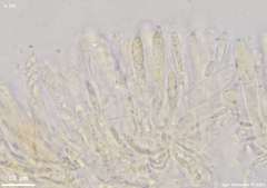Pyrenopeziza