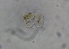 Cosmarium