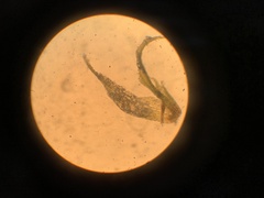 Ephemerum spinulosum