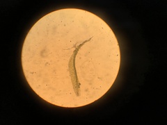 Ephemerum spinulosum