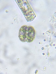 Cosmarium contractum