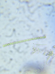 Dolichospermum flosaquae