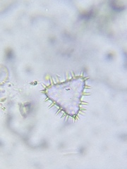 Staurastrum hystrix