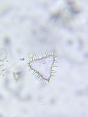 Staurastrum hystrix