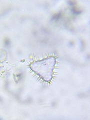 Staurastrum hystrix