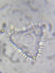 Staurastrum hystrix