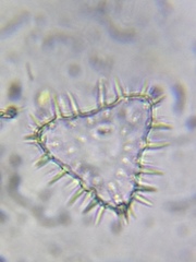 Staurastrum hystrix