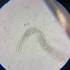 Spirostomum