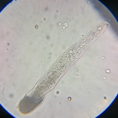 Spirostomum