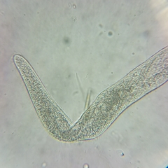 Spirostomum