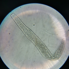 Spirostomum