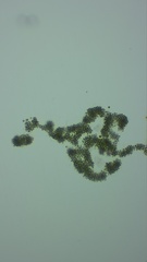 Microcystis