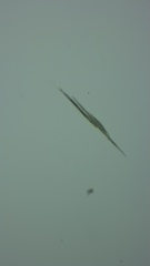 Aphanizomenon flosaquae