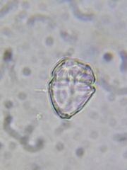 Parvodinium inconspicuum