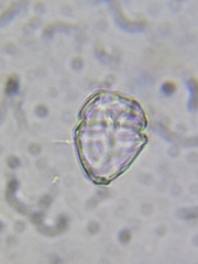 Parvodinium inconspicuum