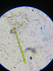 Closterium angustatum