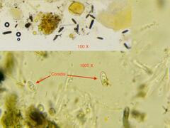 Orbilia xanthostigma