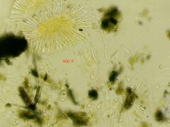 Orbilia xanthostigma