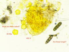 Orbilia xanthostigma