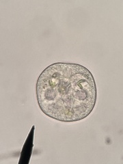 Protozoa