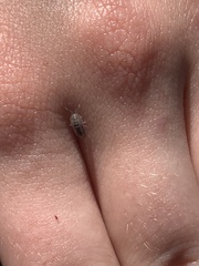 Armadillidium nasatum