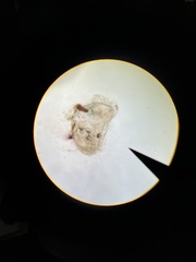Ostracoda