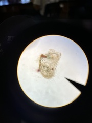 Ostracoda