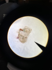 Ostracoda