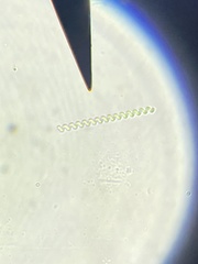 Dolichospermum