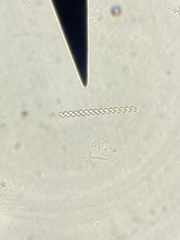 Dolichospermum