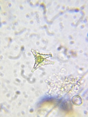 Staurastrum anatinum